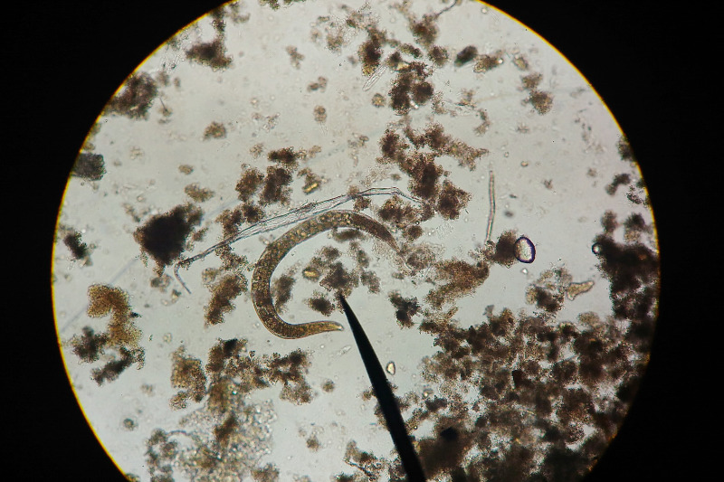 Parasiten beeinflussen die Darmgesundheit